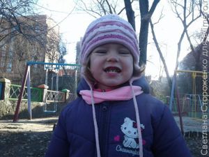 Серебрение молочных зубов — наш опыт