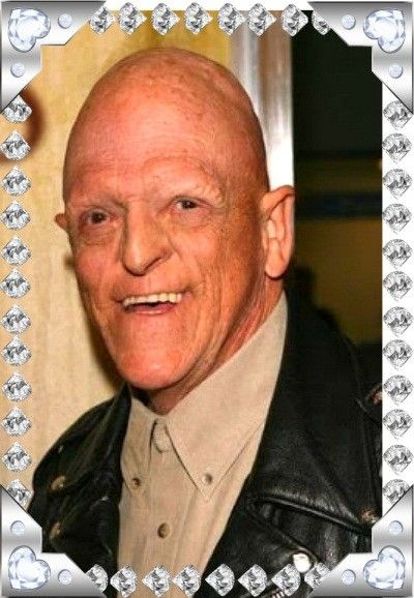 Майкл Берриман родился с диагнозом гипогидротическая эктодермальная дисплазия, при котором человек лишается волос, ногтей и зубов и вообще имеет внешность мутанта из фантастического фильма. Собственно, на ролях мутантов Берриман и специализируется. Но он также превосходно играет и в серьезных драмах, и в улетных комедиях. Майкл Берриман родился с диагнозом гипогидротическая эктодермальная дисплазия, при котором человек лишается волос, ногтей и зубов и вообще имеет внешность мутанта из фантастического фильма. Собственно, на ролях мутантов Берриман и специализируется. Но он также превосходно играет и в серьезных драмах, и в улетных комедиях.