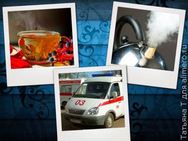 Ожог кипятком Ожог кипятком