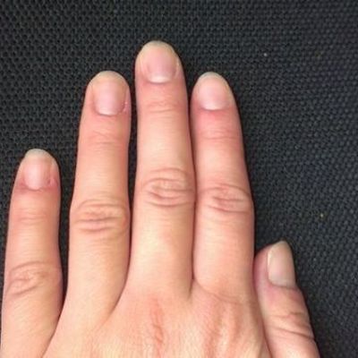Что делать, если слоятся ногти
